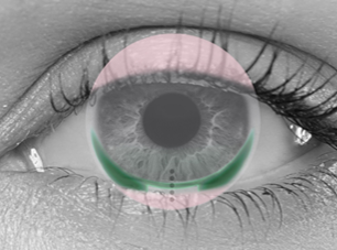 UpSide on Eye crop
